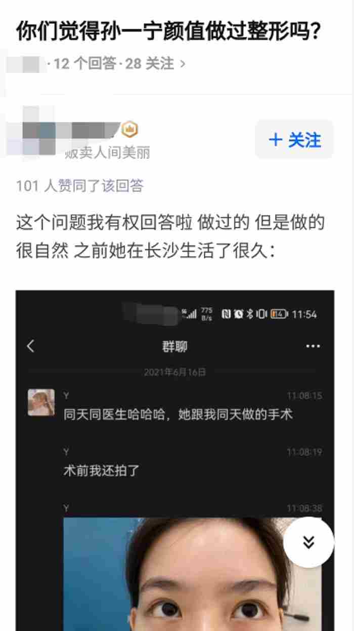 整形案例 微整前后对比照图片