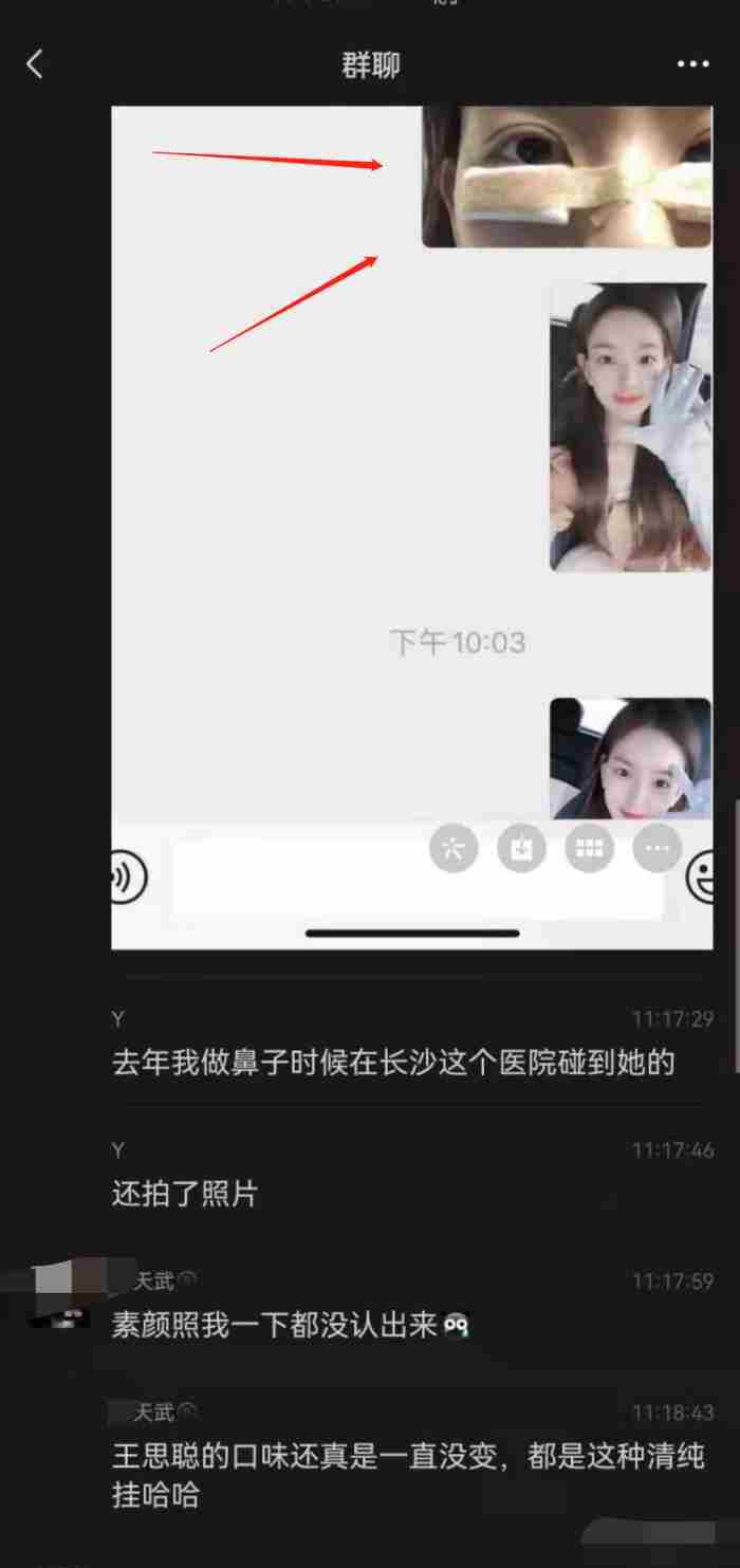 整形案例 微整前后对比照图片