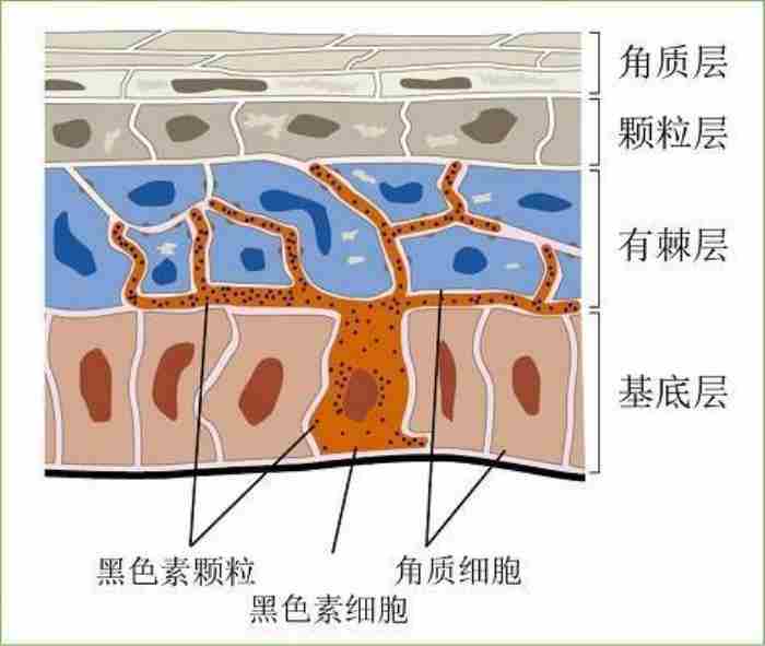 黑色素沉淀怎么去除 黑色素形成的过程是什么