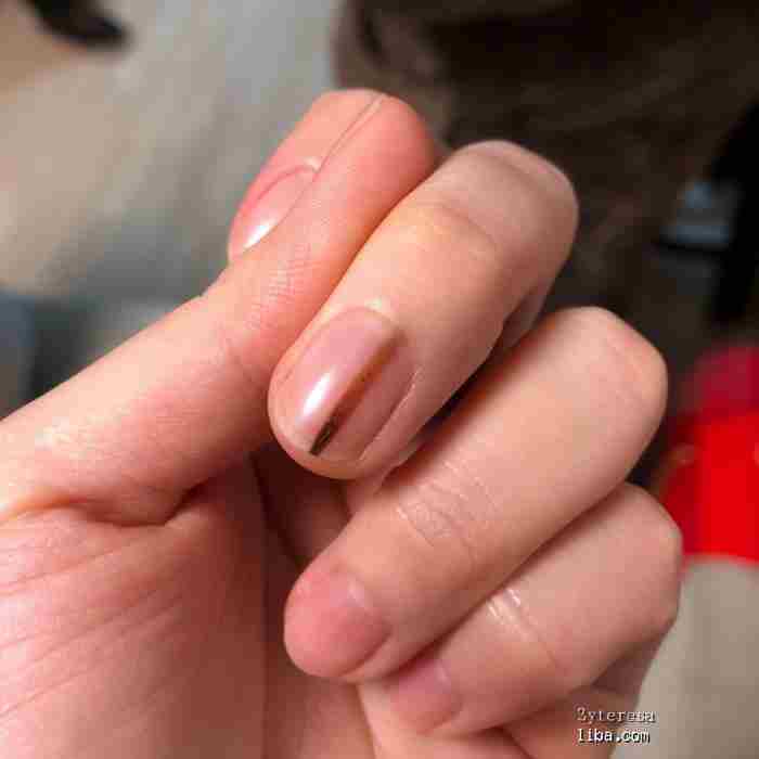 指甲上的月牙、竖纹代表什么?8种指甲问题